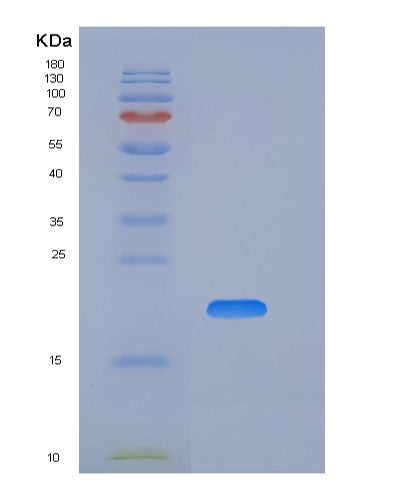 SDS-PAGE analysis of Human CD74 (Hla Class Ii Histocompatibility Antigen Gamma Chain) - Recombinant Protein, CATHuman CD74 (Hla Class Ii Histocompatibility Antigen Gamma Chain) - Recombinant Protein