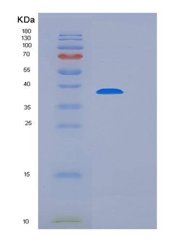 SDS-PAGE analysis of Mouse Tigit (T-Cell Immunoreceptor With Ig And Itim Domains) - Recombinant Protein, CAT# BLT-06534P, showing >85% purity under 15% SDS-PAGE (Reduced)Mouse Tigit (T-Cell Immunoreceptor With Ig And Itim Domains) - Recombinant Protein