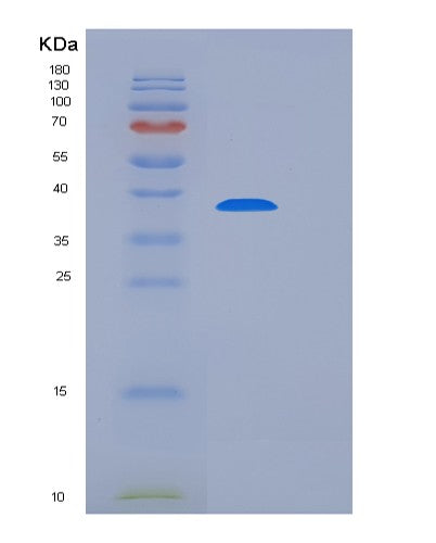 SDS-PAGE analysis of Mouse Tigit (T-Cell Immunoreceptor With Ig And Itim Domains) - Recombinant Protein, CATMouse Tigit (T-Cell Immunoreceptor With Ig And Itim Domains) - Recombinant Protein