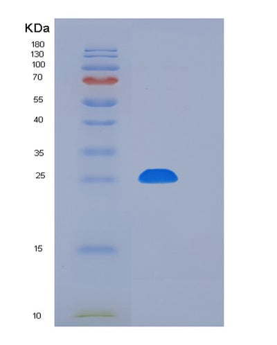SDS-PAGE analysis of Human CD226 (Cd226 Antigen) - Recombinant Protein, CAT# BLT-06535P, showing >95% purity under 15% SDS-PAGE (Reduced)Human CD226 (Cd226 Antigen) - Recombinant Protein