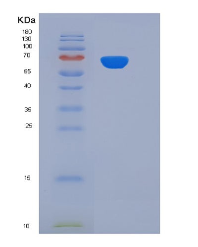 SDS-PAGE analysis of Human SMPD1 (Sphingomyelin Phosphodiesterase) - Recombinant Protein, CAT# BLT-06537P, showing >85% purity under 15% SDS-PAGE (Reduced)Human SMPD1 (Sphingomyelin Phosphodiesterase) - Recombinant Protein