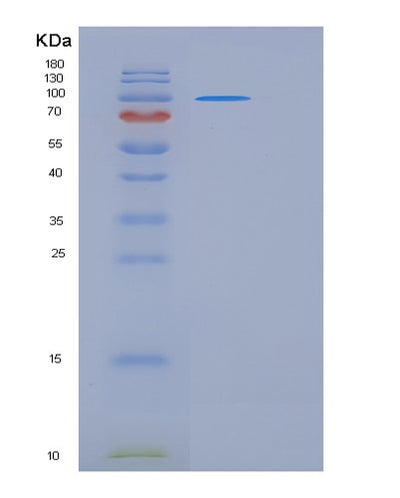 SDS-PAGE analysis of Human CNTN1 (Contactin-1) - Recombinant Protein, CAT# BLT-06538P, showing >95% purity under 15% SDS-PAGE (Reduced)Human CNTN1 (Contactin-1) - Recombinant Protein