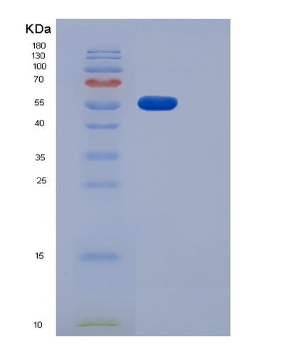 SDS-PAGE analysis of Human PDGFRA (Platelet-Derived Growth Factor Receptor Alpha) - Recombinant Protein, CAT# BLT-06550P, showing >85% purity under 15% SDS-PAGE (Reduced)Human PDGFRA (Platelet-Derived Growth Factor Receptor Alpha) - Recombinant Protein