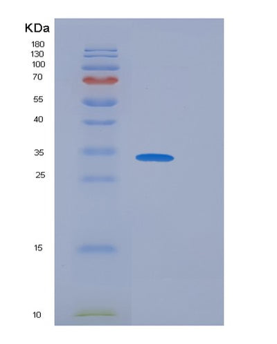 SDS-PAGE analysis of Mouse Fcgr1 (High Affinity Immunoglobulin Gamma Fc Receptor I) - Recombinant Protein, CAT# BLT-06552P, showing >90% purity under 15% SDS-PAGE (Reduced)Mouse Fcgr1 (High Affinity Immunoglobulin Gamma Fc Receptor I) - Recombinant Protein