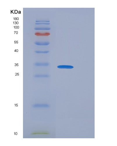 SDS-PAGE analysis of Mouse Fcgr1 (High Affinity Immunoglobulin Gamma Fc Receptor I) - Recombinant Protein, CATMouse Fcgr1 (High Affinity Immunoglobulin Gamma Fc Receptor I) - Recombinant Protein