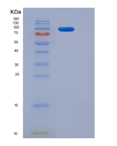 SDS-PAGE analysis of Human INSR (Insulin Receptor) - Recombinant Protein, CAT# BLT-06557P, showing >95% purity under 15% SDS-PAGE (Reduced)Human INSR (Insulin Receptor) - Recombinant Protein