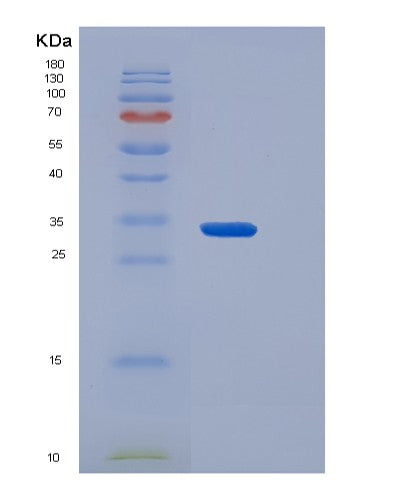 SDS-PAGE analysis of Mouse Fcgr1 (High Affinity Immunoglobulin Gamma Fc Receptor I) - Recombinant Protein, CATMouse Fcgr1 (High Affinity Immunoglobulin Gamma Fc Receptor I) - Recombinant Protein