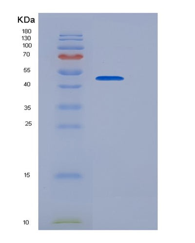 SDS-PAGE analysis of Human ADAMTSL1 (Adamts-Like Protein 1) - Recombinant Protein, CAT# BLT-06560P, showing >90% purity under 15% SDS-PAGE (Reduced)Human ADAMTSL1 (Adamts-Like Protein 1) - Recombinant Protein