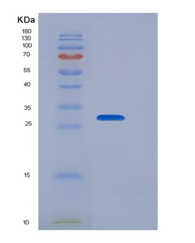SDS-PAGE analysis of Human IL2RG (Cytokine Receptor Common Subunit Gamma) - Recombinant Protein, CAT# BLT-06561P, showing >85% purity under 15% SDS-PAGE (Reduced)Human IL2RG (Cytokine Receptor Common Subunit Gamma) - Recombinant Protein