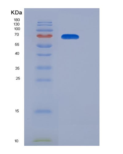 SDS-PAGE analysis of Mouse Il12rb2 (Interleukin-12 Receptor Subunit Beta-2) - Recombinant Protein, CAT# BLT-06562P, showing >95% purity under 15% SDS-PAGE (Reduced)Mouse Il12rb2 (Interleukin-12 Receptor Subunit Beta-2) - Recombinant Protein