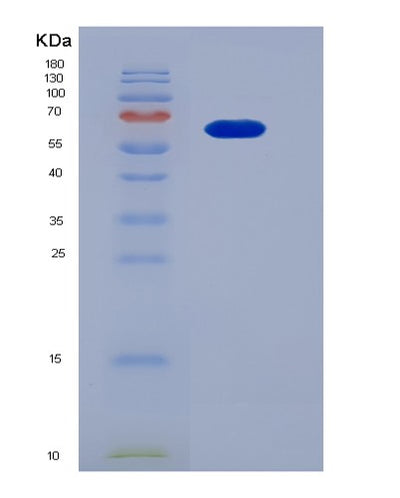 SDS-PAGE analysis of Human FGFR4 (Fibroblast Growth Factor Receptor 4) - Recombinant Protein, CAT# BLT-06572P, showing >95% purity under 15% SDS-PAGE (Reduced)Human FGFR4 (Fibroblast Growth Factor Receptor 4) - Recombinant Protein