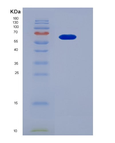 SDS-PAGE analysis of Human FGFR4 (Fibroblast Growth Factor Receptor 4) - Recombinant Protein, CATHuman FGFR4 (Fibroblast Growth Factor Receptor 4) - Recombinant Protein