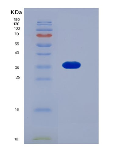 SDS-PAGE analysis of Mouse Il13ra1 (Interleukin-13 Receptor Subunit Alpha-1) - Recombinant Protein, CAT# BLT-06573P, showing >90% purity under 15% SDS-PAGE (Reduced)Mouse Il13ra1 (Interleukin-13 Receptor Subunit Alpha-1) - Recombinant Protein