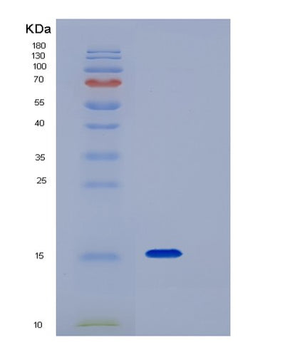 SDS-PAGE analysis of Human TNFRSF19 (Tumor Necrosis Factor Receptor Superfamily Member 19) - Recombinant Protein, CAT# BLT-06577P, showing >95% purity under 15% SDS-PAGE (Reduced)Human TNFRSF19 (Tumor Necrosis Factor Receptor Superfamily Member 19) - Recombinant Protein