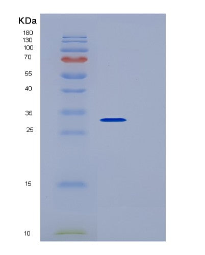 SDS-PAGE analysis of Mouse Fcgr1 (High Affinity Immunoglobulin Gamma Fc Receptor I) - Recombinant Protein, CATMouse Fcgr1 (High Affinity Immunoglobulin Gamma Fc Receptor I) - Recombinant Protein