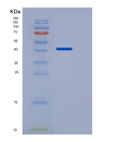 SDS-PAGE analysis of Human TNFRSF19 (Tumor Necrosis Factor Receptor Superfamily Member 19) - Recombinant Protein, CATHuman TNFRSF19 (Tumor Necrosis Factor Receptor Superfamily Member 19) - Recombinant Protein