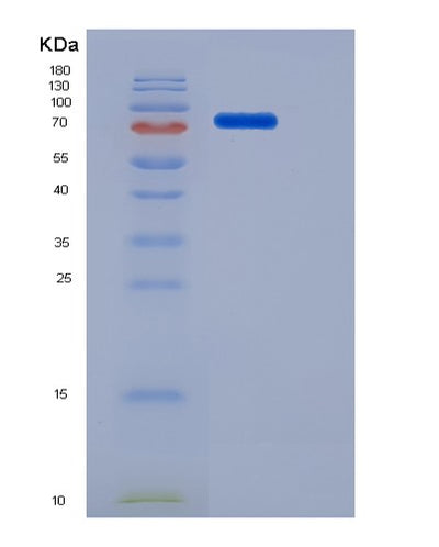 SDS-PAGE analysis of Mouse Csf1r (Macrophage Colony-Stimulating Factor 1 Receptor) - Recombinant Protein, CAT# BLT-06585P, showing >95% purity under 15% SDS-PAGE (Reduced)Mouse Csf1r (Macrophage Colony-Stimulating Factor 1 Receptor) - Recombinant Protein