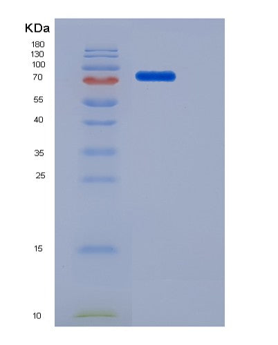 SDS-PAGE analysis of Mouse Csf1r (Macrophage Colony-Stimulating Factor 1 Receptor) - Recombinant Protein, CATMouse Csf1r (Macrophage Colony-Stimulating Factor 1 Receptor) - Recombinant Protein
