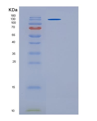 SDS-PAGE analysis of Human PAPPA2 (Pappalysin-2) - Recombinant Protein, CAT# BLT-06590P, showing >95% purity under 15% SDS-PAGE (Reduced)Human PAPPA2 (Pappalysin-2) - Recombinant Protein