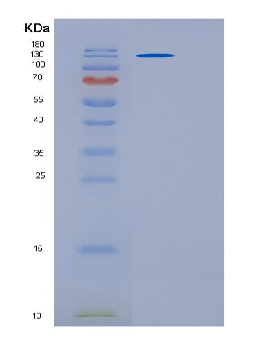 SDS-PAGE analysis of Human PAPPA2 (Pappalysin-2) - Recombinant Protein, CATHuman PAPPA2 (Pappalysin-2) - Recombinant Protein