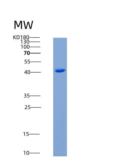 SDS-PAGE analysis of Human TNFRSF10B (Tumor Necrosis Factor Receptor Superfamily Member 10B) - Recombinant Protein, CAT# BLT-06633P, showing >90% purity under 15% SDS-PAGE (Reduced)Human TNFRSF10B (Tumor Necrosis Factor Receptor Superfamily Member 10B) - Recombinant Protein