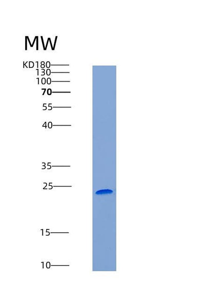 SDS-PAGE analysis of Human MBL2 (Mannose-Binding Protein C) - Recombinant Protein, CAT# BLT-06714P, showing >90% purity under 15% SDS-PAGE (Reduced)Human MBL2 (Mannose-Binding Protein C) - Recombinant Protein