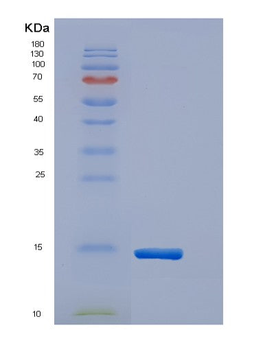 SDS-PAGE analysis of Human TNFRSF13B (Tumor Necrosis Factor Receptor Superfamily Member 13B) - Recombinant Protein, CATHuman TNFRSF13B (Tumor Necrosis Factor Receptor Superfamily Member 13B) - Recombinant Protein