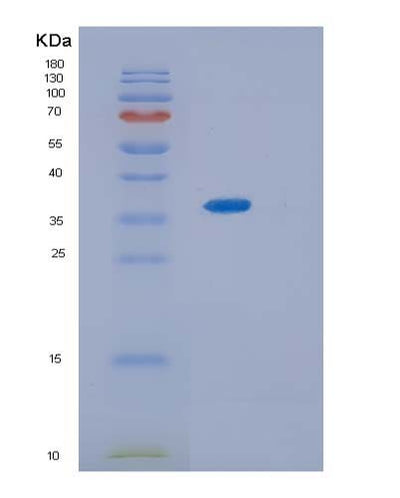 SDS-PAGE analysis of Mouse Il13ra2 (Interleukin-13 Receptor Subunit Alpha-2) - Recombinant Protein, CAT# BLT-06727P, showing >85% purity under 15% SDS-PAGE (Reduced)Mouse Il13ra2 (Interleukin-13 Receptor Subunit Alpha-2) - Recombinant Protein