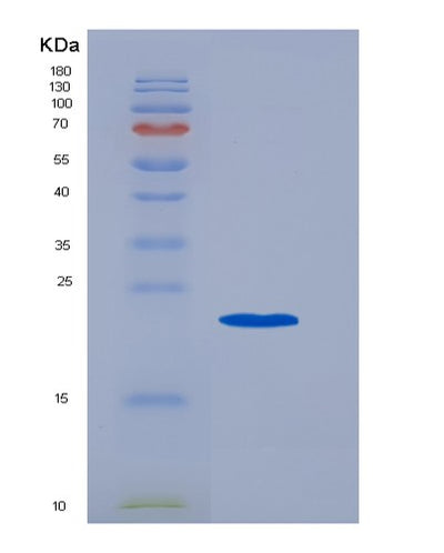 SDS-PAGE analysis of Mouse Fcgr3 (Low Affinity Immunoglobulin Gamma Fc Region Receptor Iii) - Recombinant Protein, CAT# BLT-06734P, showing >90% purity under 15% SDS-PAGE (Reduced)Mouse Fcgr3 (Low Affinity Immunoglobulin Gamma Fc Region Receptor Iii) - Recombinant Protein