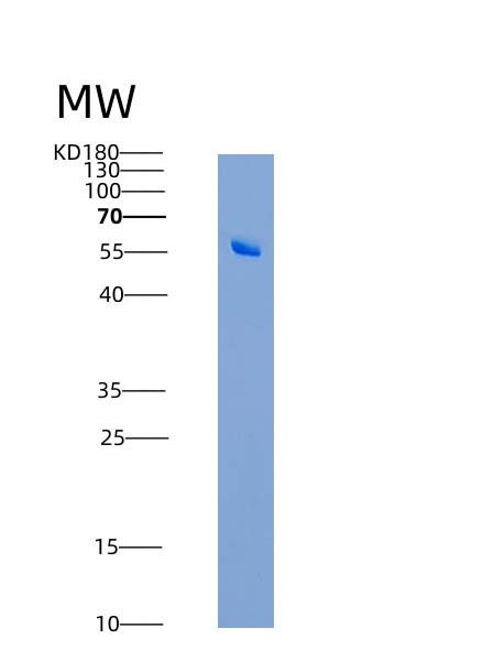 SDS-PAGE analysis of Mouse Cd96 (T-Cell Surface Protein Tactile) - Recombinant Protein, CATMouse Cd96 (T-Cell Surface Protein Tactile) - Recombinant Protein