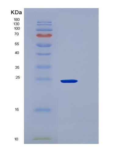 SDS-PAGE analysis of Mouse Cd84 (Slam Family Member 5) - Recombinant Protein, CAT# BLT-06741P, showing >90% purity under 15% SDS-PAGE (Reduced)Mouse Cd84 (Slam Family Member 5) - Recombinant Protein