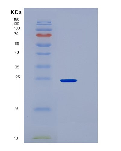 SDS-PAGE analysis of Mouse Cd84 (Slam Family Member 5) - Recombinant Protein, CATMouse Cd84 (Slam Family Member 5) - Recombinant Protein