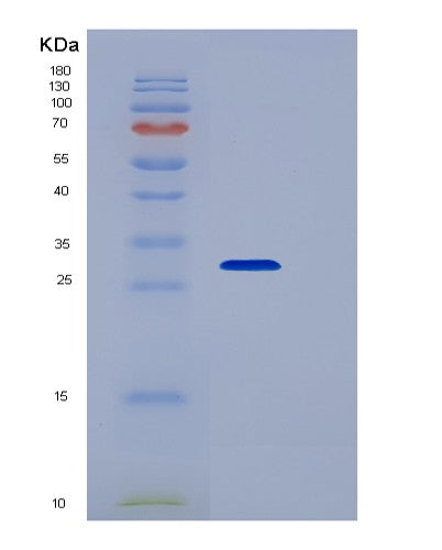 SDS-PAGE analysis of Human RNASET2 (Ribonuclease T2) - Recombinant Protein, CATHuman RNASET2 (Ribonuclease T2) - Recombinant Protein