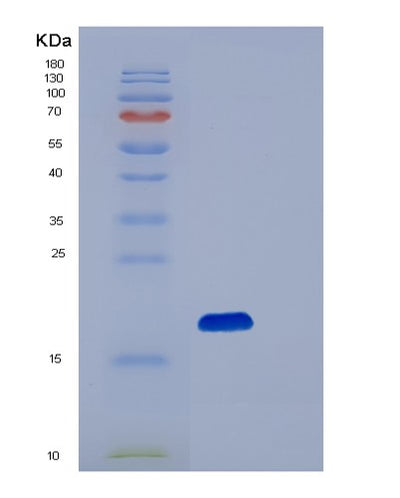SDS-PAGE analysis of Human PIN1 (Peptidyl-Prolyl Cis-Trans Isomerase Nima-Interacting 1) - Recombinant Protein, CAT# BLT-06750P, showing >90% purity under 15% SDS-PAGE (Reduced)Human PIN1 (Peptidyl-Prolyl Cis-Trans Isomerase Nima-Interacting 1) - Recombinant Protein
