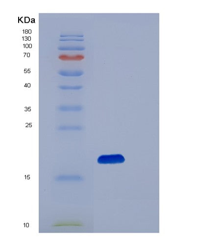 SDS-PAGE analysis of Human PIN1 (Peptidyl-Prolyl Cis-Trans Isomerase Nima-Interacting 1) - Recombinant Protein, CATHuman PIN1 (Peptidyl-Prolyl Cis-Trans Isomerase Nima-Interacting 1) - Recombinant Protein