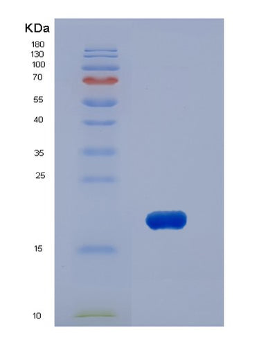 SDS-PAGE analysis of Human PIN1 (Peptidyl-Prolyl Cis-Trans Isomerase Nima-Interacting 1) - Recombinant Protein, CAT# BLT-06753P, showing >90% purity under 15% SDS-PAGE (Reduced)Human PIN1 (Peptidyl-Prolyl Cis-Trans Isomerase Nima-Interacting 1) - Recombinant Protein