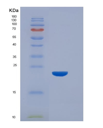 SDS-PAGE analysis of Mouse Fcgr4 (Low Affinity Immunoglobulin Gamma Fc Region Receptor Iii-A) - Recombinant Protein, CAT# BLT-06760P, showing >85% purity under 15% SDS-PAGE (Reduced)Mouse Fcgr4 (Low Affinity Immunoglobulin Gamma Fc Region Receptor Iii-A) - Recombinant Protein
