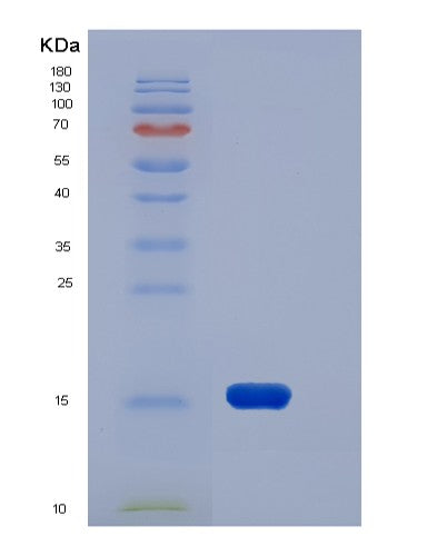 SDS-PAGE analysis of Human EDA2R (Tumor Necrosis Factor Receptor Superfamily Member 27) - Recombinant Protein, CATHuman EDA2R (Tumor Necrosis Factor Receptor Superfamily Member 27) - Recombinant Protein