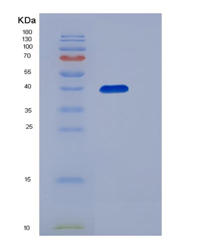 SDS-PAGE analysis of Human ACVR2A (Activin Receptor Type-2A) - Recombinant Protein, CAT# BLT-06777P, showing >90% purity under 15% SDS-PAGE (Reduced)Human ACVR2A (Activin Receptor Type-2A) - Recombinant Protein
