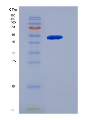SDS-PAGE analysis of Human MMP8 (Neutrophil Collagenase) - Recombinant Protein, CAT# BLT-06792P, showing >90% purity under 15% SDS-PAGE (Reduced)Human MMP8 (Neutrophil Collagenase) - Recombinant Protein
