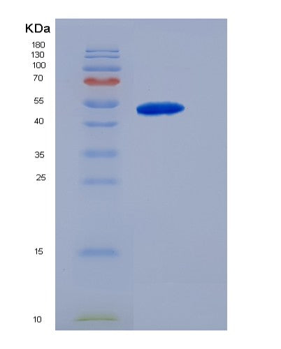 SDS-PAGE analysis of Human MMP8 (Neutrophil Collagenase) - Recombinant Protein, CATHuman MMP8 (Neutrophil Collagenase) - Recombinant Protein