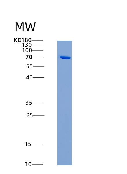 SDS-PAGE analysis of Mouse Nlgn1 (Neuroligin-1) - Recombinant Protein, CATMouse Nlgn1 (Neuroligin-1) - Recombinant Protein