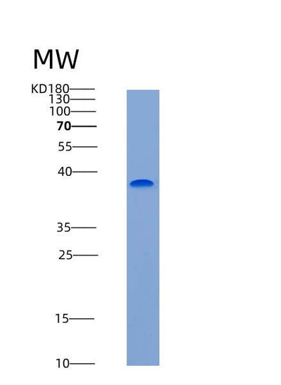 SDS-PAGE analysis of Human ACVR1 (Activin Receptor Type-1) - Recombinant Protein, CAT# BLT-06826P, showing >95% purity under 15% SDS-PAGE (Reduced)Human ACVR1 (Activin Receptor Type-1) - Recombinant Protein