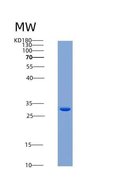 SDS-PAGE analysis of Mouse Clec10a (C-Type Lectin Domain Family 10 Member A) - Recombinant Protein, CATMouse Clec10a (C-Type Lectin Domain Family 10 Member A) - Recombinant Protein