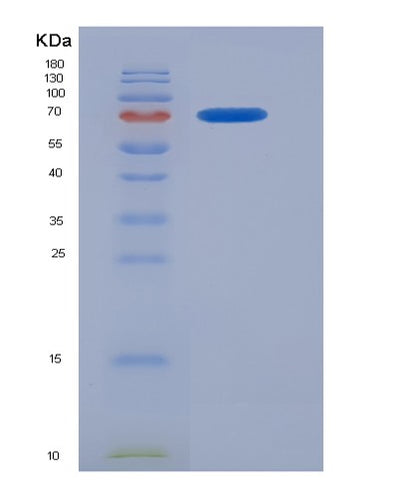 SDS-PAGE analysis of Human FGFR1 (Fibroblast Growth Factor Receptor 1) - Recombinant Protein, CAT# BLT-07018P, showing >85% purity under 15% SDS-PAGE (Reduced)Human FGFR1 (Fibroblast Growth Factor Receptor 1) - Recombinant Protein