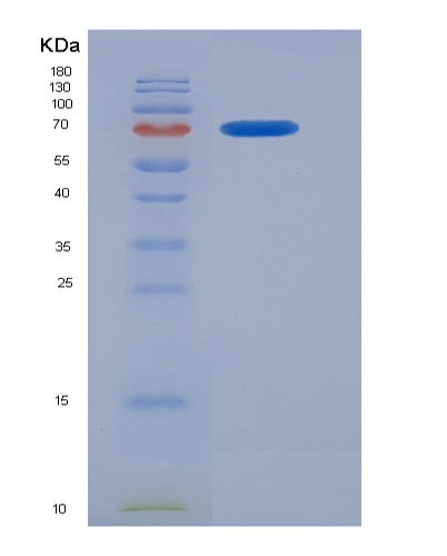 SDS-PAGE analysis of Human FGFR1 (Fibroblast Growth Factor Receptor 1) - Recombinant Protein, CATHuman FGFR1 (Fibroblast Growth Factor Receptor 1) - Recombinant Protein