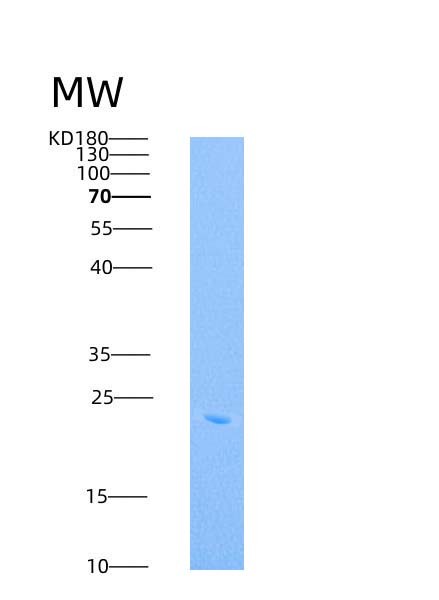 SDS-PAGE analysis of Human ICAM2 (Intercellular Adhesion Molecule 2) - Recombinant Protein, CATHuman ICAM2 (Intercellular Adhesion Molecule 2) - Recombinant Protein