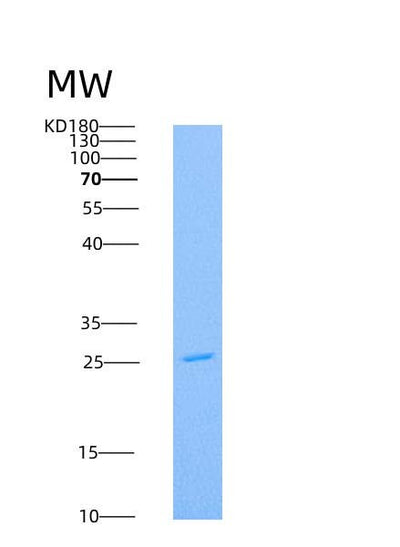 SDS-PAGE analysis of Human AK4 (Adenylate Kinase 4, Mitochondrial) - Recombinant Protein, CAT# BLT-07095P, showing >90% purity under 15% SDS-PAGE (Reduced)Human AK4 (Adenylate Kinase 4, Mitochondrial) - Recombinant Protein