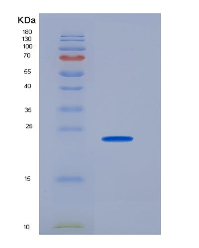 SDS-PAGE analysis of Human FCGR3A (Low Affinity Immunoglobulin Gamma Fc Region Receptor Iii-A) - Recombinant Protein, CAT# BLT-04849P, showing >95% purity under 15% SDS-PAGE (Reduced)Human FCGR3A (Low Affinity Immunoglobulin Gamma Fc Region Receptor Iii-A) - Recombinant Protein