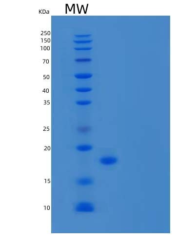 SDS-PAGE analysis of Human AGR3 (Anterior Gradient Protein 3) - Recombinant Protein, CAT# BLT-03677P, showing >95% purity under 15% SDS-PAGE (Reduced)Human AGR3 (Anterior Gradient Protein 3) - Recombinant Protein